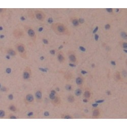 Glucuronidase Beta (GUSb) Antibody