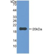 Western blot analysis of recombinant Rabbit IL1b.