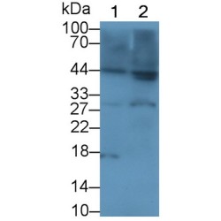 Interleukin 1 Beta (IL1B) Antibody