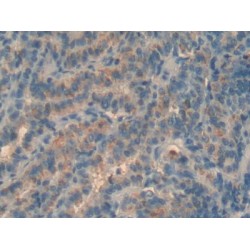 Bone Marrow Proteoglycan (PRG2) Antibody