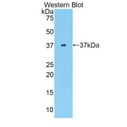 Western blot analysis of the recombinant protein.