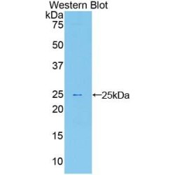 Sprouty Homolog 1 (SPRY1) Antibody