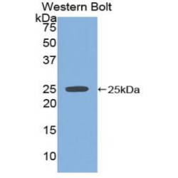 Sprouty Homolog 2 (SPRY2) Antibody