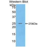 Western blot analysis of recombinant Human SPRY3.