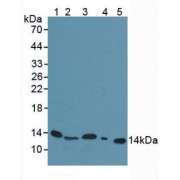 Western blot analysis of (1) Mouse Serum, (2) Mouse Spleen Tissue, (3) Mouse Liver Tissue, (4) Rat Liver Tissue and (5) Human Urine.