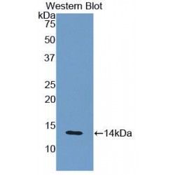 Beta-2-Microglobulin (B2M) Antibody