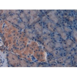 Beta-Thromboglobulin (bTG) Antibody