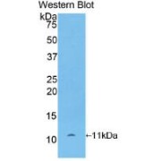 Western blot analysis of recombinant Rat bTG.