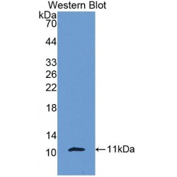 Beta-Thromboglobulin (bTG) Antibody