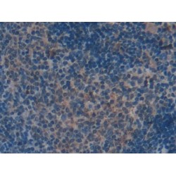 Beta-Thromboglobulin (bTG) Antibody