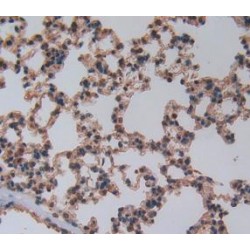 Beta-Thromboglobulin (bTG) Antibody