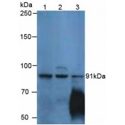 Western blot analysis of (1) Human MCF-7 Cells, (2) Human 304 Cells and (3) Human Liver Tissue.