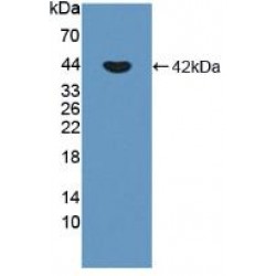 Cadherin-3 (CDH3) Antibody