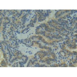 Cadherin-3 (CDH3) Antibody