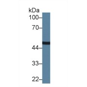 Western blot analysis of Human A549 cell lysate, using Human CPN1 Antibody (1.5 µg/ml) and HRP-conjugated Goat Anti-Rabbit antibody (<a href="https://www.abbexa.com/index.php?route=product/search&amp;search=abx400043" target="_blank">abx400043</a>, 0.2 µg/ml).