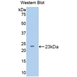 Carboxypeptidase N1 (CPN1) Antibody