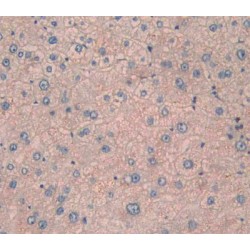 Carboxypeptidase N1 (CPN1) Antibody