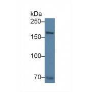 Western blot analysis of Rat Skin lysate, using Human COL17 Antibody (3 µg/ml) and HRP-conjugated Goat Anti-Rabbit antibody (<a href="https://www.abbexa.com/index.php?route=product/search&amp;search=abx400043" target="_blank">abx400043</a>, 0.2 µg/ml).