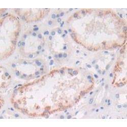 Interleukin 1 Alpha (IL1a) Antibody
