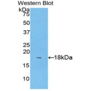 Western blot analysis of the recombinant protein.