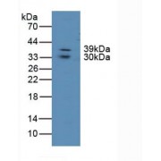 Western blot analysis of Human Lung Tissue.