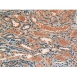 Lipase, Endothelial (LIPG) Antibody