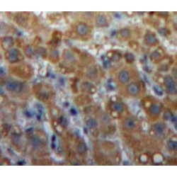 Lipase, Endothelial (LIPG) Antibody