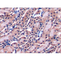 Lymphocyte Antigen 9 (LY9) Antibody