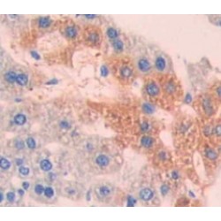 NADH Dehydrogenase 1 (ND1) Antibody