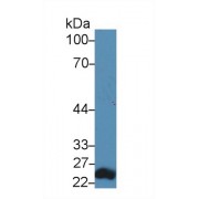 Western blot analysis of Mouse Lung lysate, using Human RAGE Antibody (5 µg/ml) and HRP-conjugated Goat Anti-Rabbit antibody (<a href="https://www.abbexa.com/index.php?route=product/search&amp;search=abx400043" target="_blank">abx400043</a>, 0.2 µg/ml).