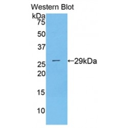 MAPK/MAK/MRK Overlapping Kinase (MOK) Antibody