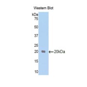 Western blot analysis of the recombinant protein.