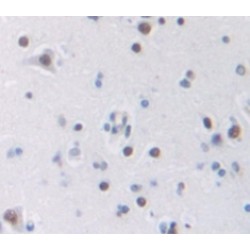 Transformer 2 Beta (TRA2b) Antibody