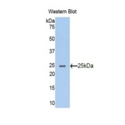 Western blot analysis of the recombinant protein.