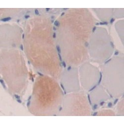 Acetylcholinesterase (AChE) Antibody