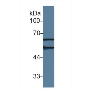 Western blot analysis of Human Jurkat cell lysate, using Rat AchE Antibody (1 µg/ml) and HRP-conjugated Goat Anti-Rabbit antibody (<a href="https://www.abbexa.com/index.php?route=product/search&amp;search=abx400043" target="_blank">abx400043</a>, 0.2 µg/ml).