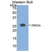 Western blot analysis of the recombinant protein.