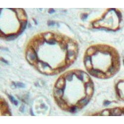 Adenylate Cyclase 6 (ADCY6) Antibody