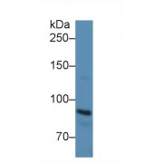 Western blot analysis of Rat Serum, using Rat CDHE Antibody (3 µg/ml) and HRP-conjugated Goat Anti-Rabbit antibody (<a href="https://www.abbexa.com/index.php?route=product/search&amp;search=abx400043" target="_blank">abx400043</a>, 0.2 µg/ml).