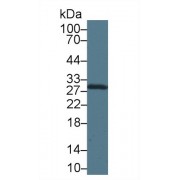 Western blot analysis of Mouse Heart lysate, using Mouse CA2 Antibody (1 µg/ml) and HRP-conjugated Goat Anti-Rabbit antibody (<a href="https://www.abbexa.com/index.php?route=product/search&amp;search=abx400043" target="_blank">abx400043</a>, 0.2 µg/ml).
