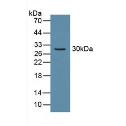 Carbonic Anhydrase II (CA2) Antibody