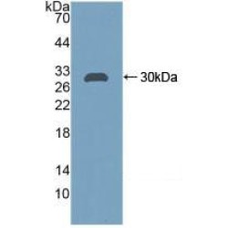 Carbonic Anhydrase II (CA2) Antibody