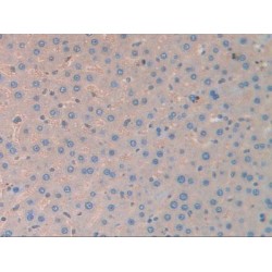 Carbonic Anhydrase II (CA2) Antibody