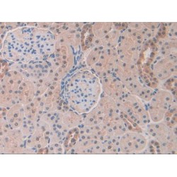 Carbonic Anhydrase II (CA2) Antibody