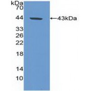 Western blot analysis of recombinant Human CA9.