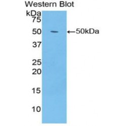 Enolase, Non Neuronal (NNE) Antibody