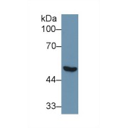 Western blot analysis of Human Lung lysate, using Human NNE Antibody (1 µg/ml) and HRP-conjugated Goat Anti-Rabbit antibody (<a href="https://www.abbexa.com/index.php?route=product/search&amp;search=abx400043" target="_blank">abx400043</a>, 0.2 µg/ml).