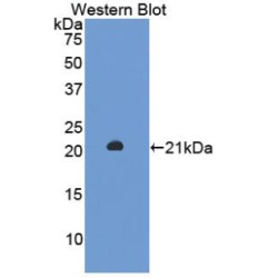 Enolase, Non Neuronal (NNE) Antibody