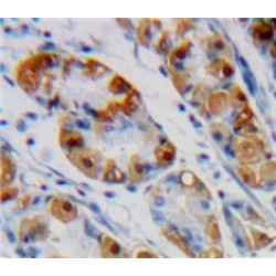 Enolase, Non Neuronal (NNE) Antibody