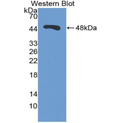 Enolase, Non Neuronal (NNE) Antibody